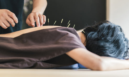 how acupuncture can help your skin