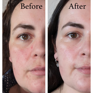 natural skin care for 40+ skin